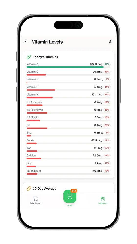 Calorie Scan Calorie Scanner — AI-Powered Nutrition Tracking